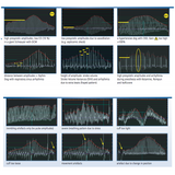 Medidor presion arterial HDO oscilometrico