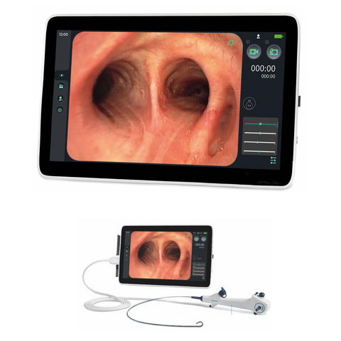 Endoscopio Eickview 150SD MONITOR / PROCESADOR