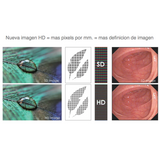 Endoscopio flexible AHOUA HD