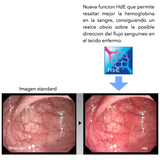 Endoscopio flexible AHOUA HD